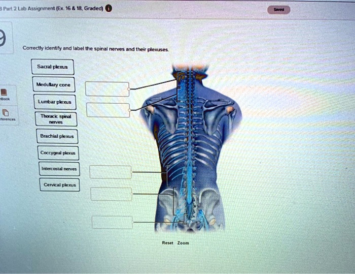 Correctly identify and label the spinal nerves and their plexuses.