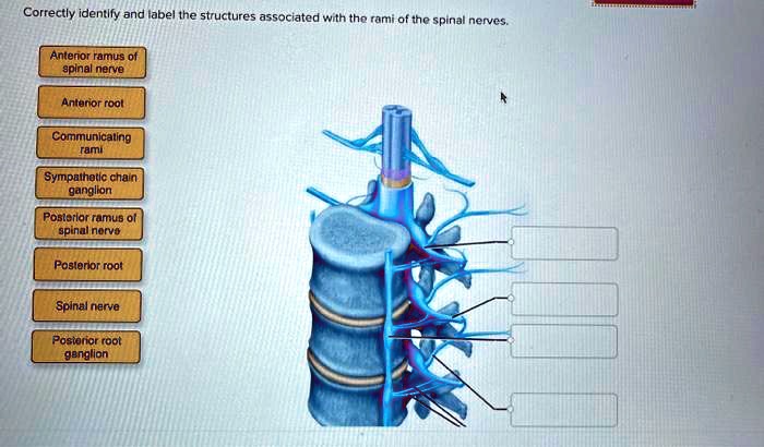 Correctly identify and label the spinal nerves and their plexuses.